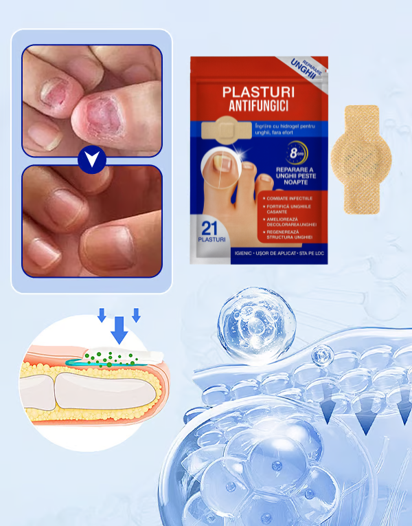 Plasturi Antifungici