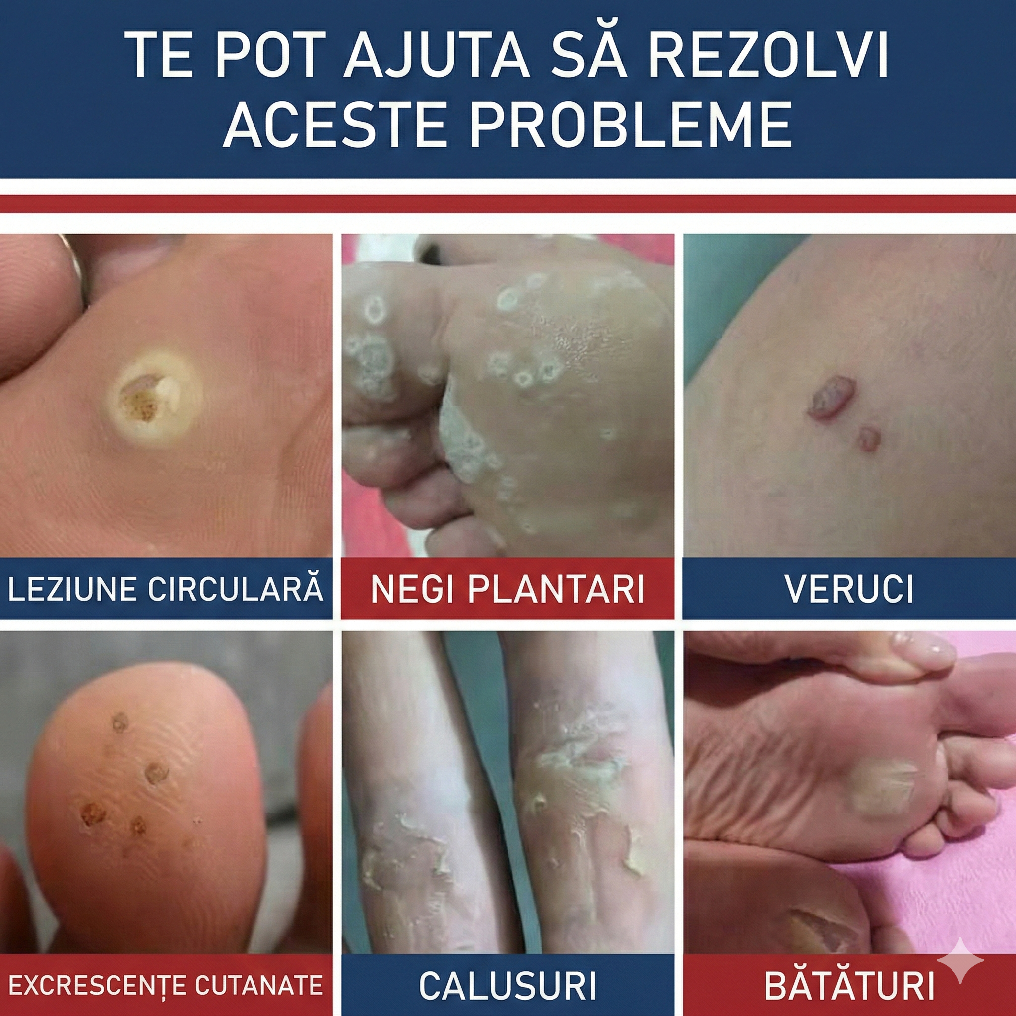 Plasturi pentru bataturi, calusuri si veruci